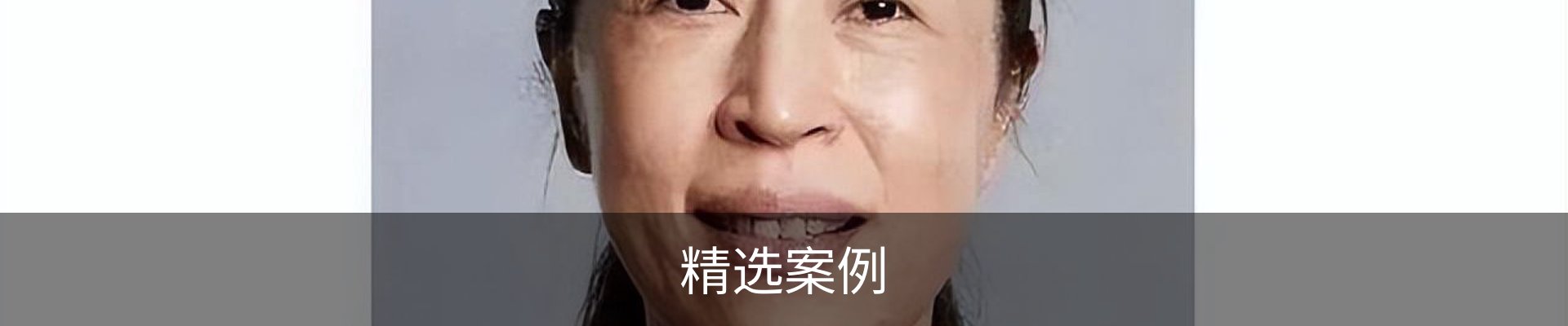 精选案例
